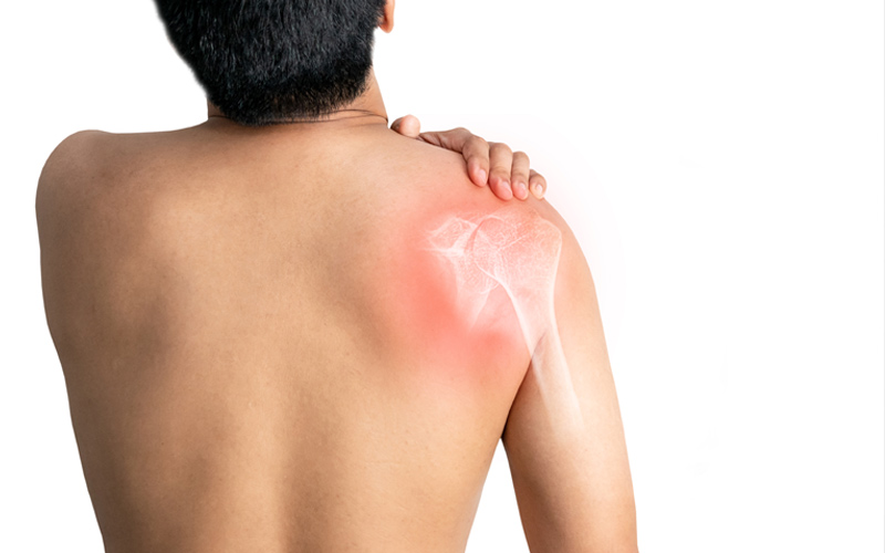 Can-Shoulder-Pain-Heal-on-Its-Own-img-f